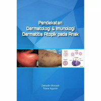 Pendekatan Dermatologi dan Imunologi Dermatitis Atopik pada Anak