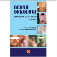 Bedah Onkologi Diagnosis dan Terapi