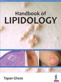 Handbook of Lipidology