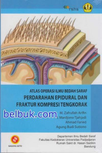 Atlas Operasi Ilmu Bedah Saraf Perdarahan Epidural dan Fraktur Kompresi Tengkorak