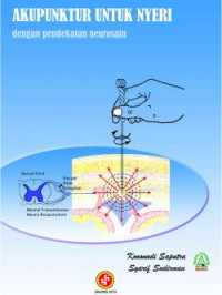 Akupunktur untuk Nyeri dengan Pendekatan Neurosain