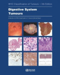 Digestive System Tumours